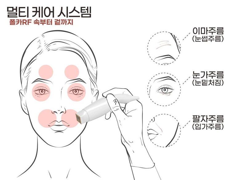 폴카 RF 피부관리 기기 프락셀 고주파 프락셔널 피부 관리기 프락셀 피부재생 콜라겐생성 리프팅 노화 눈가주름 - 한국