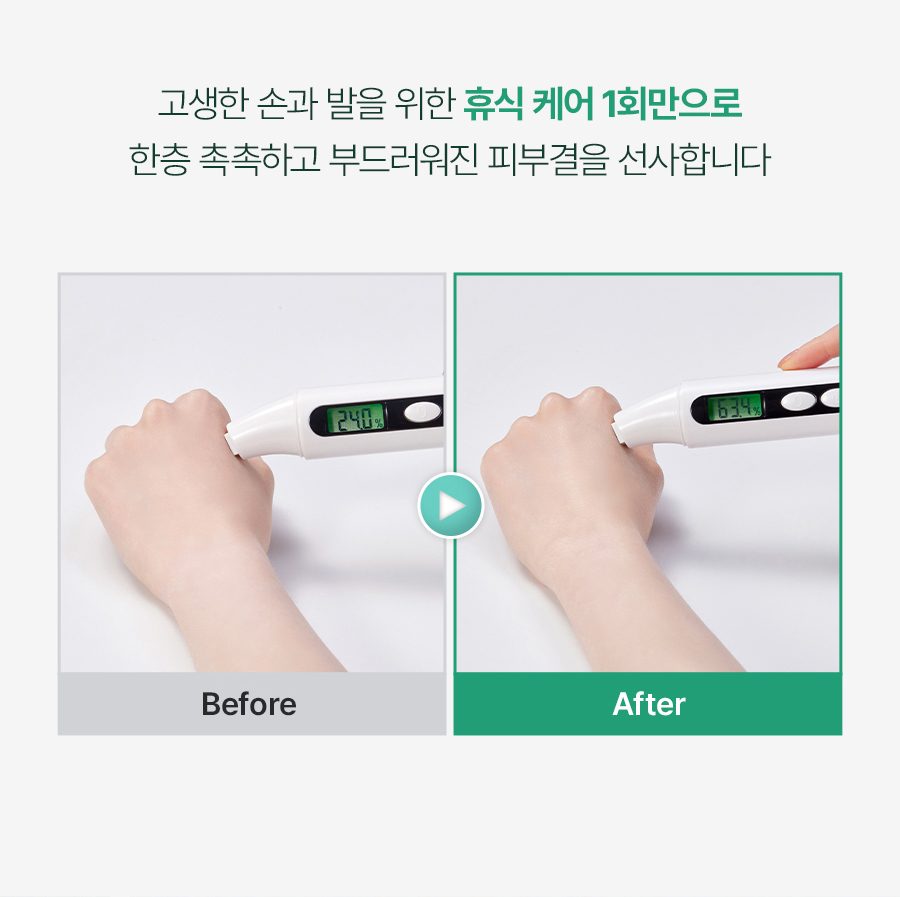 [하루10분 손목찜질로 시원하게!] 하루미담 가정용 파라핀 치료기x병원용 왁스 모음